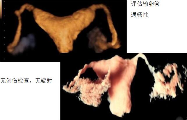 QQ截图20170322081544.jpg QQ截图20170322081544.jpg