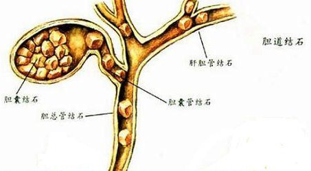 图片,.png