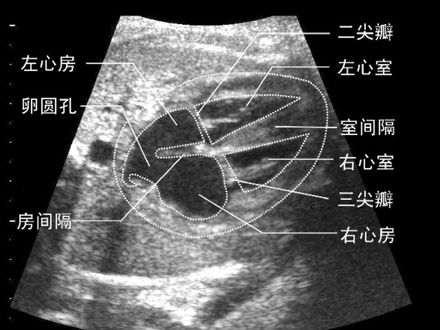 心脏.jpg