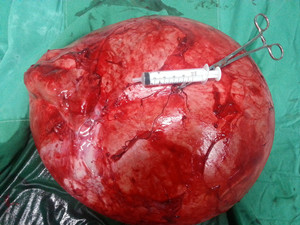 7:切除的左肾2_副本.jpg 7:切除的左肾2_副本.jpg